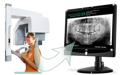 panoramica-dentaria